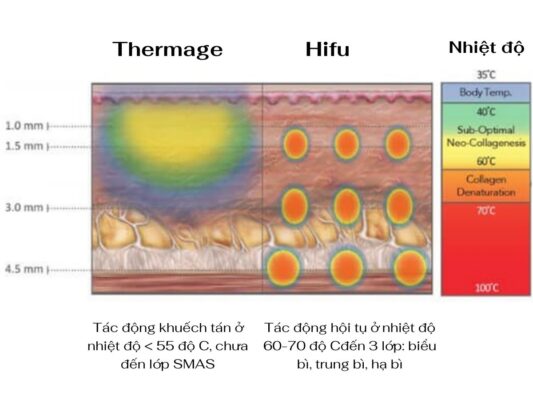 Tác động 3 độ sâu của Ultherapy