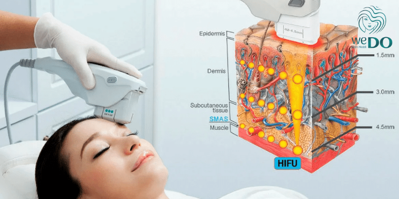 Phác đồ nâng cơ mặt tuổi trung niên Quận 2